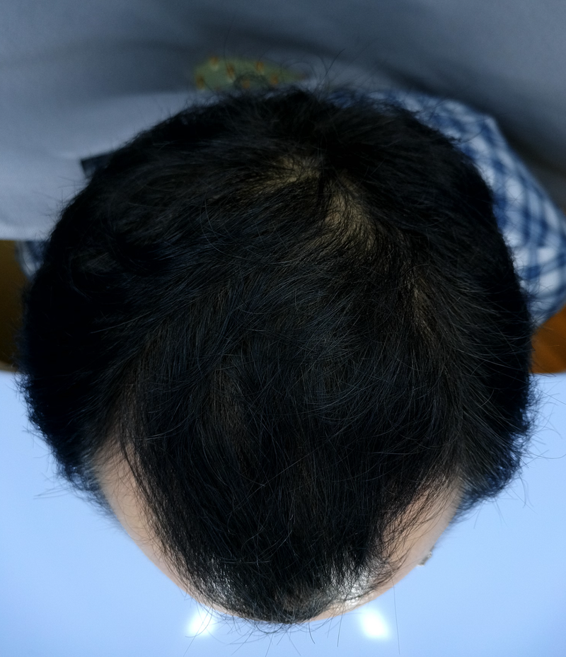 관리치료6개월2.PNG