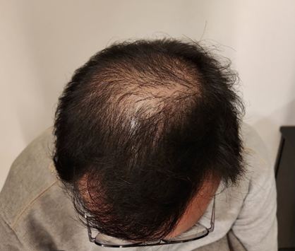 치료 12회차.png