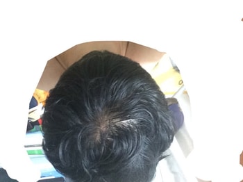 빗질 안한 정수리