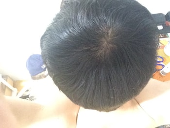머리 정리 한 후