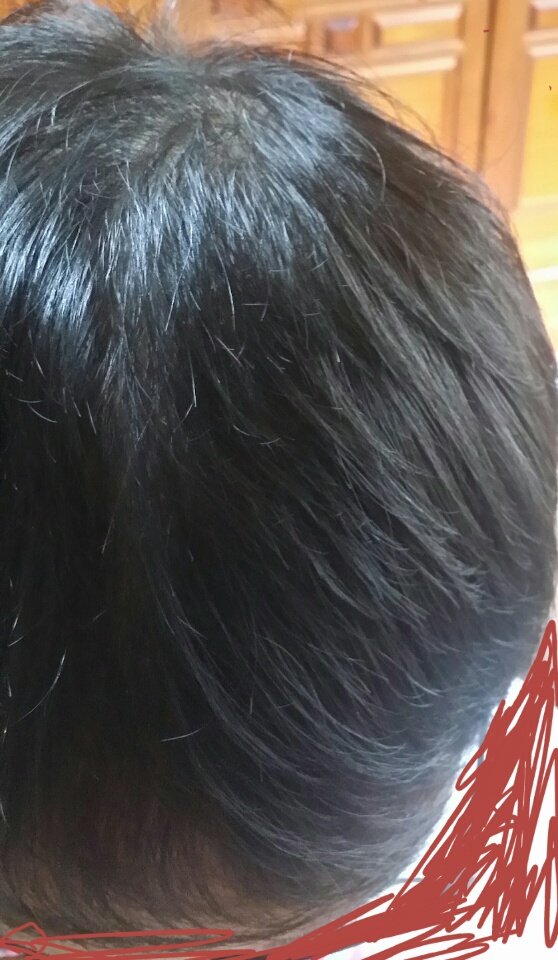 이마