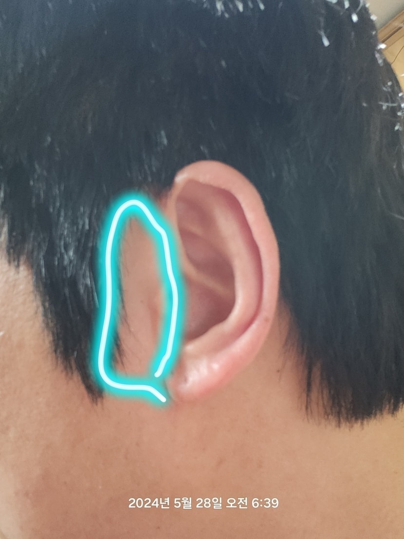 왼쪽 정상 위치