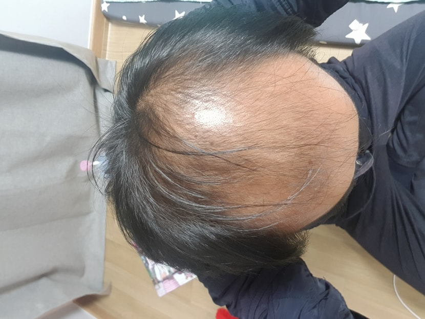 윗부분