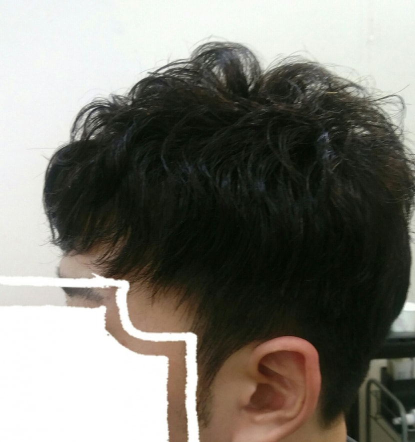 측면