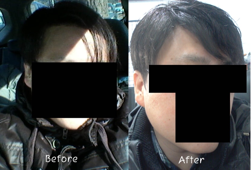 before&after