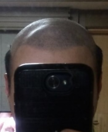 테잎을 하기위해 시원하게 밀었어요