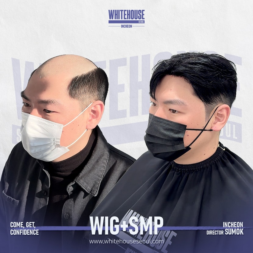 짧은가발+두피문신