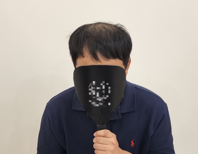 정수리가진짜 다 날라갔습니다...