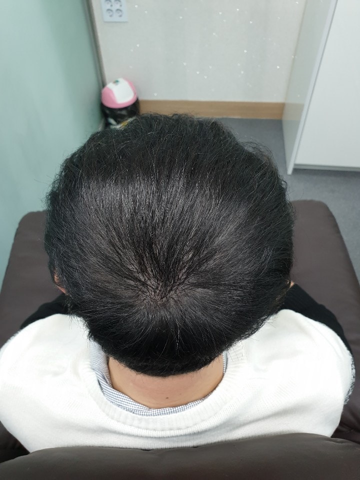 리터치 후