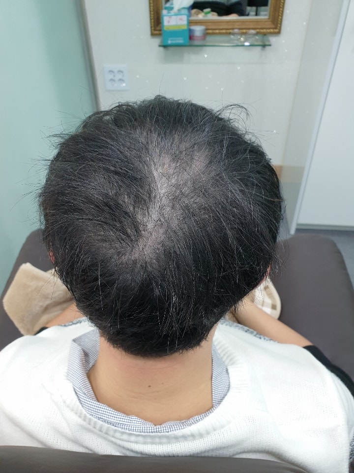 리터치 전