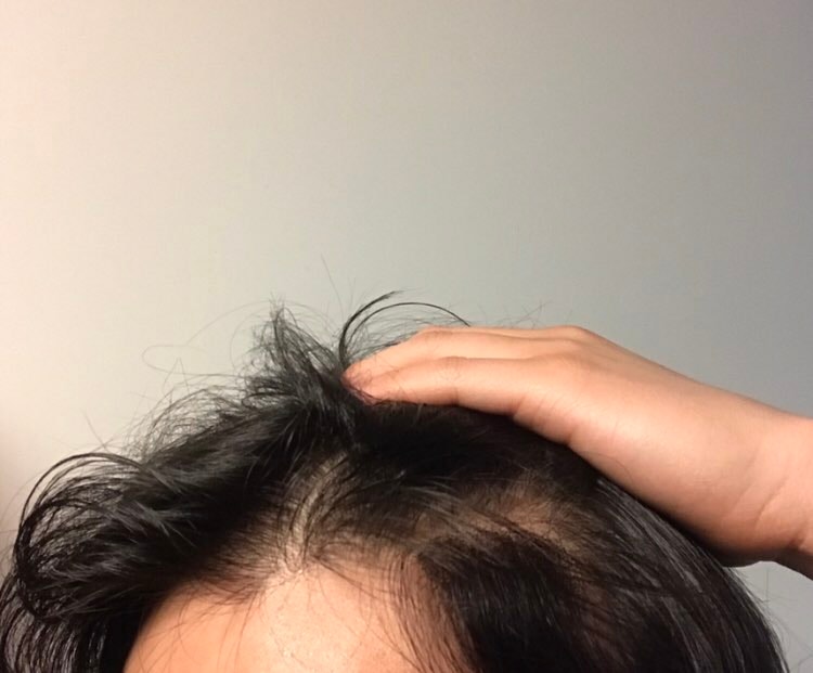 부착부위가 잘보이시나요??