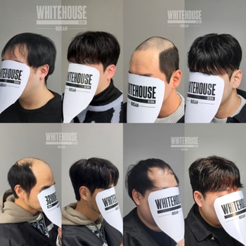 남자 맞춤 가발