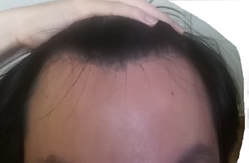 앞머리
