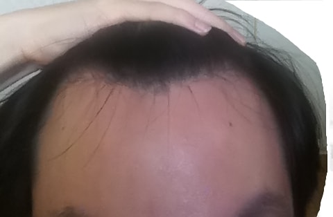 앞머리