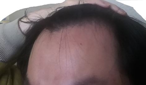 측면머리