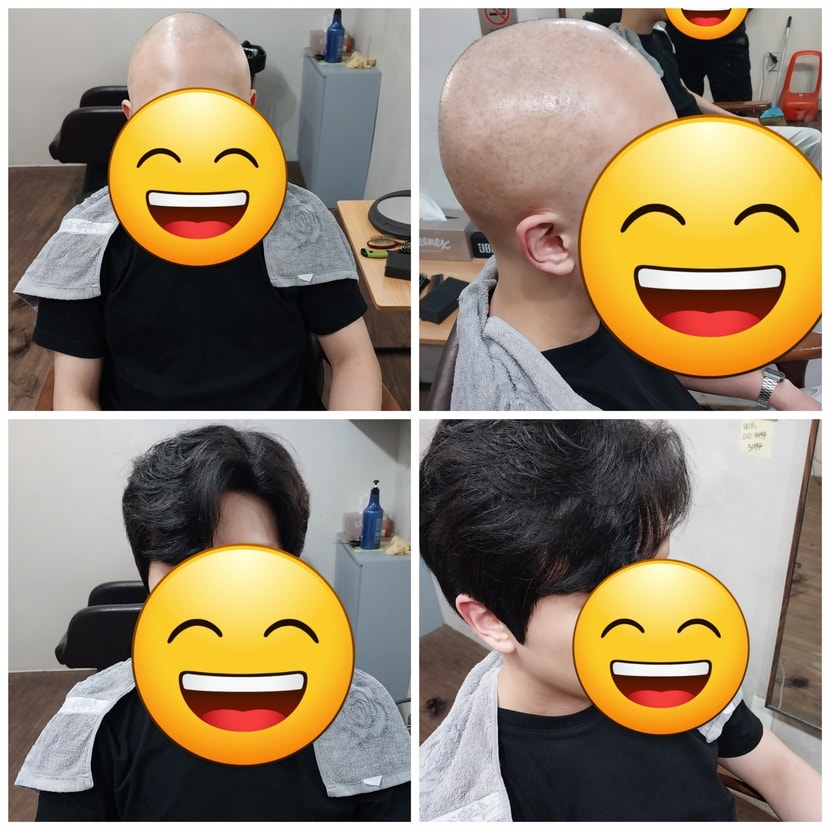 전체가발