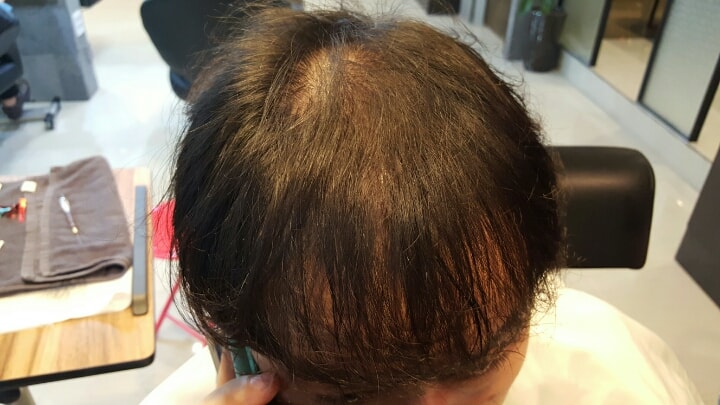 단백질 제거후 