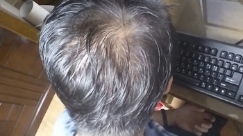 부끄럽지만... 떡진 제 본머리입니다.ㅜ_ㅜ