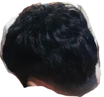5. 후면A