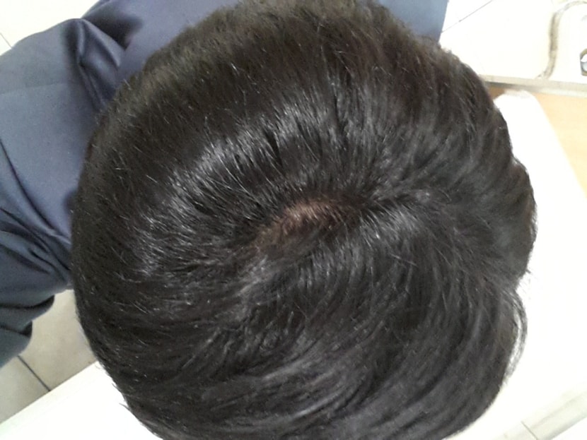 8.하루 후