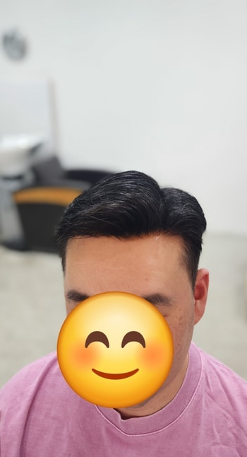 플러스모발 남성맞춤가발  30대 시술후기 