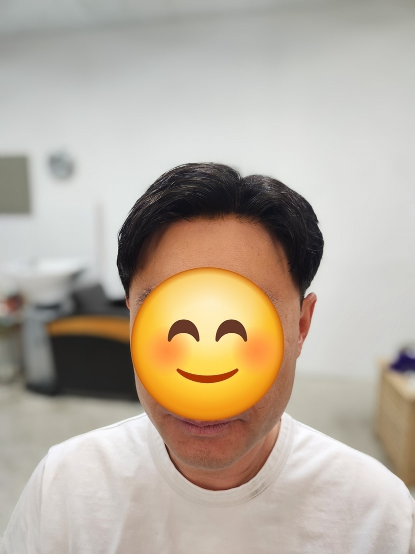 플러스모발 남성맞춤가발  40대 시술후기  