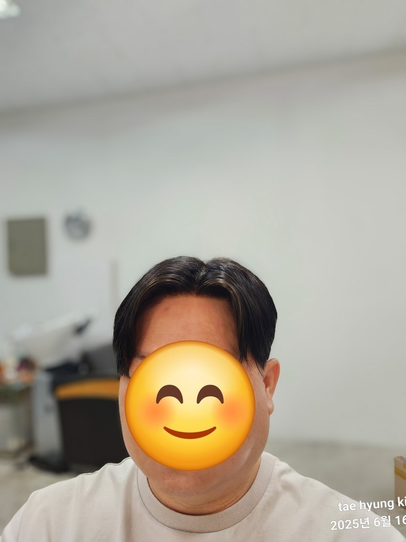 플러스모발 남성맞춤가발  부분가발 그라데이션 나노스킨 고정식  멀티부착식 40대 시술후기 