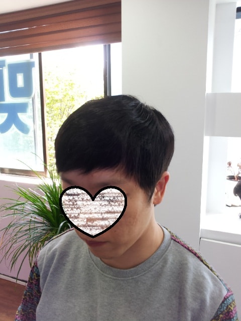 앞모습