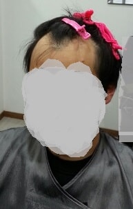 M가발 착용전 모습