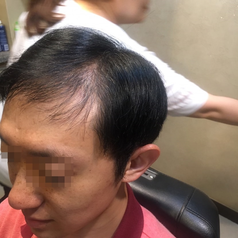 이것도 그그냥 제머리 옆에서 본모습