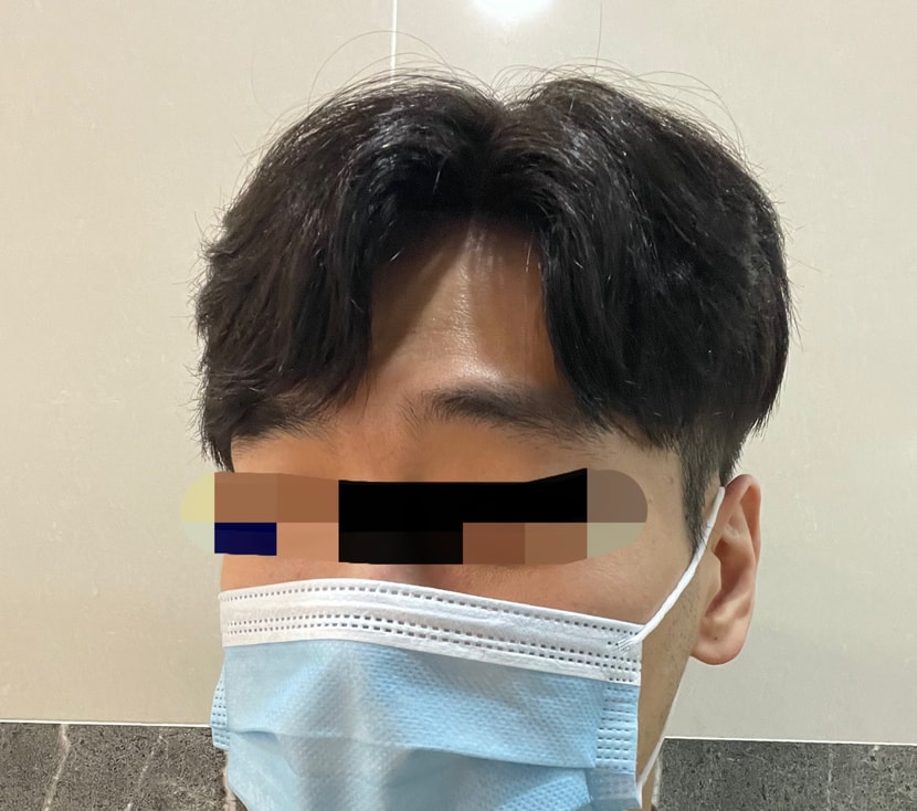 가발