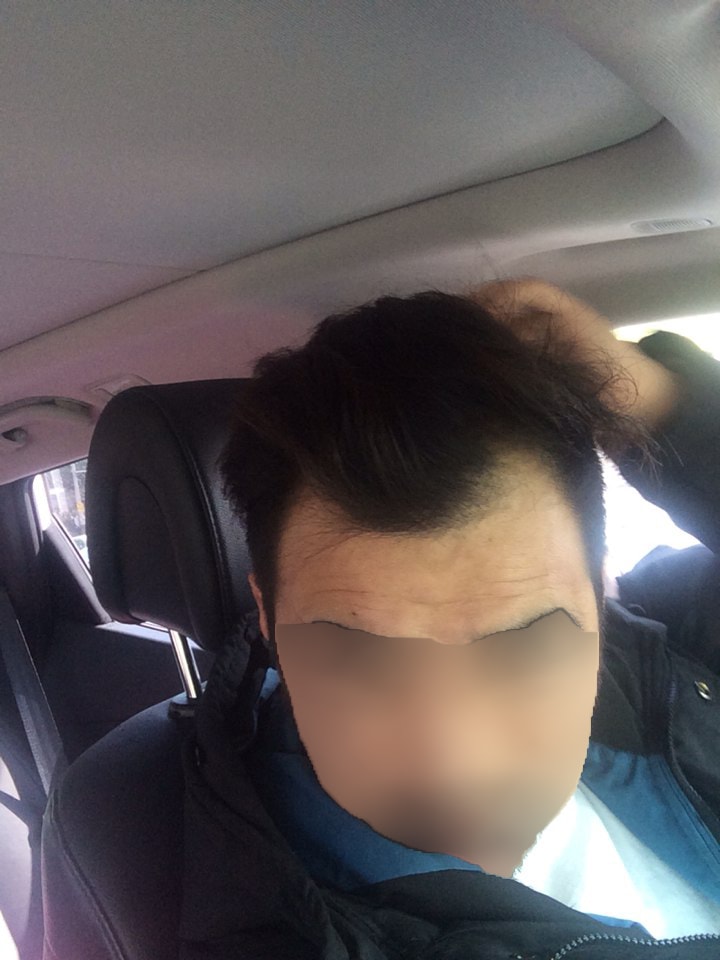 하기전