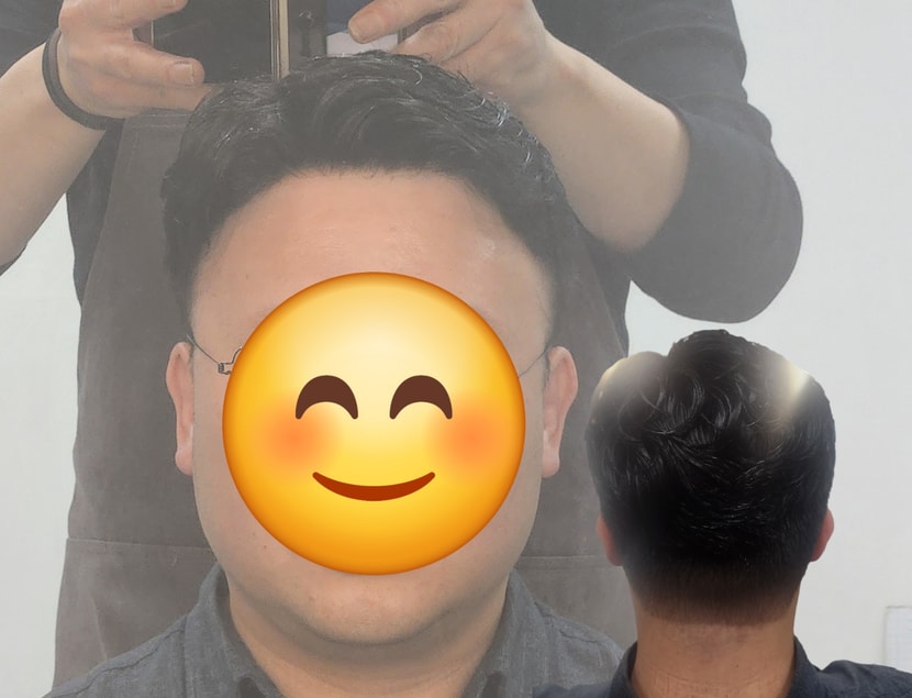플러스모발 남성맞춤가발  40대 시술후기 