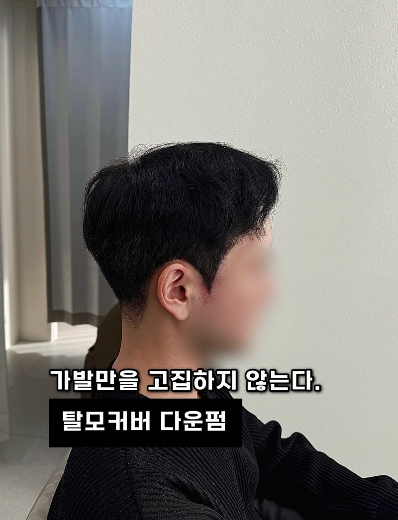 일산 남자 탈모커버 디자인 다운펌