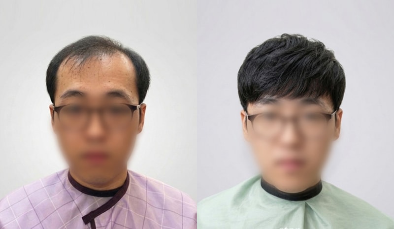 부담 없이 쓰기 좋은 남자가발 스타일