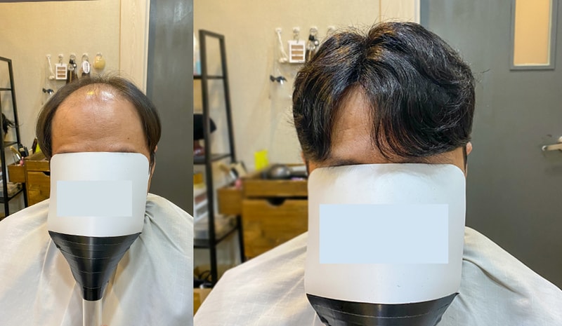 대다모 가르마펌1 정면.jpg