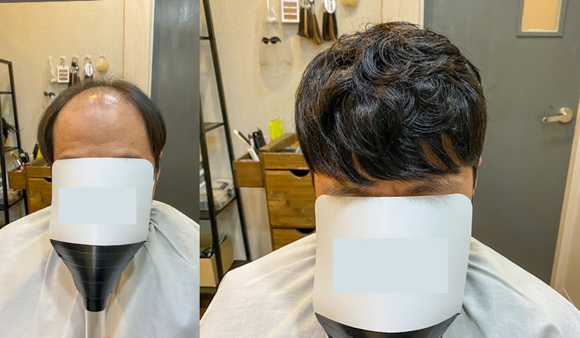 디자인볼륨펌 앞모습 비포&에프터