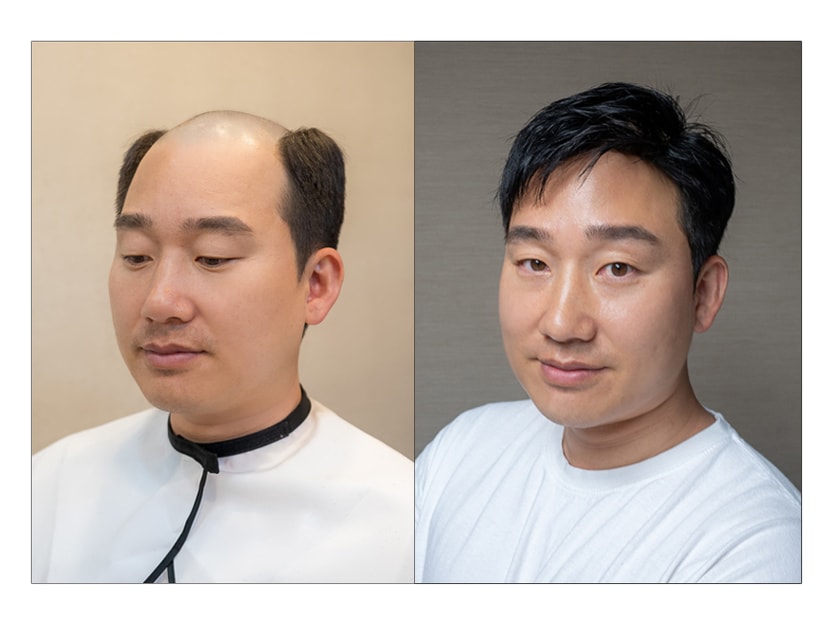 가발 착용전과 후