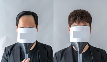 비포&에프터