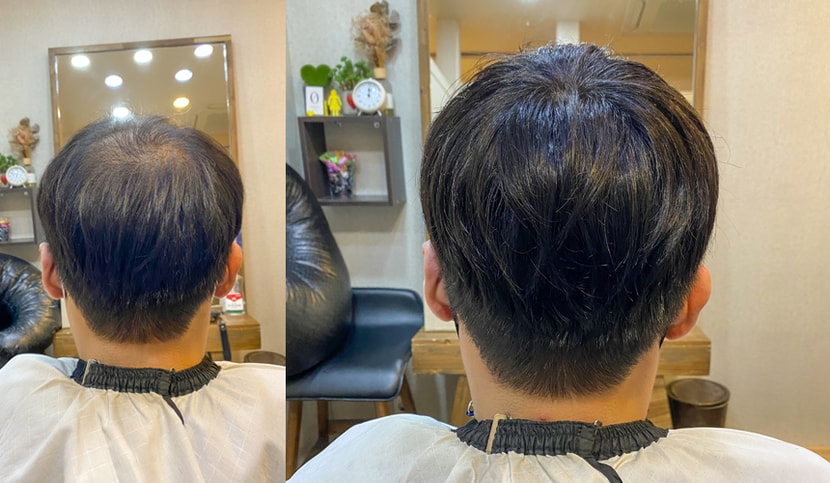 디자인 볼륨펌 뒷모습 비포&에프터