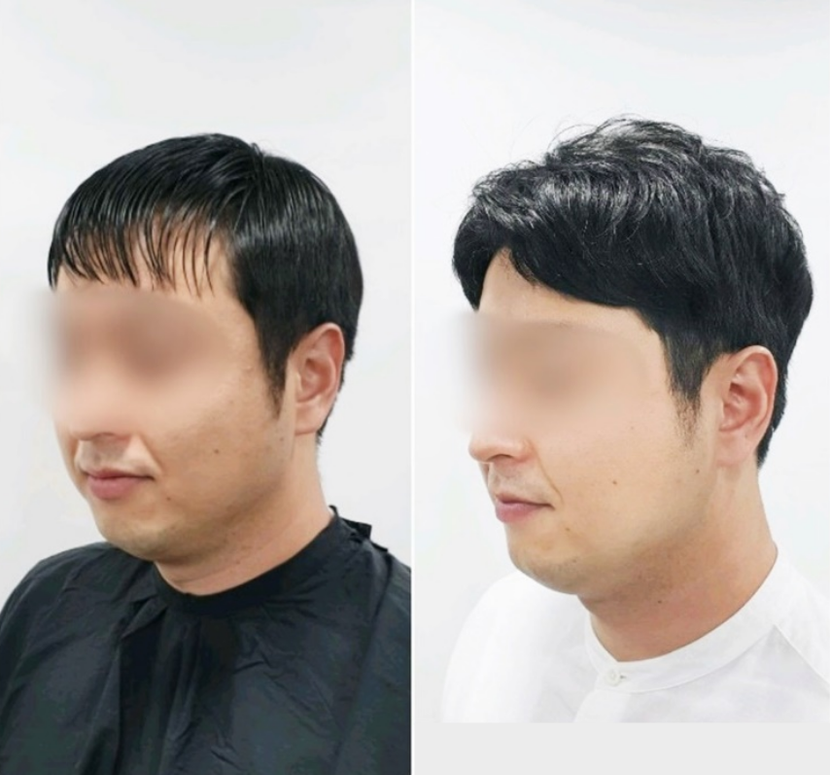 3000모
