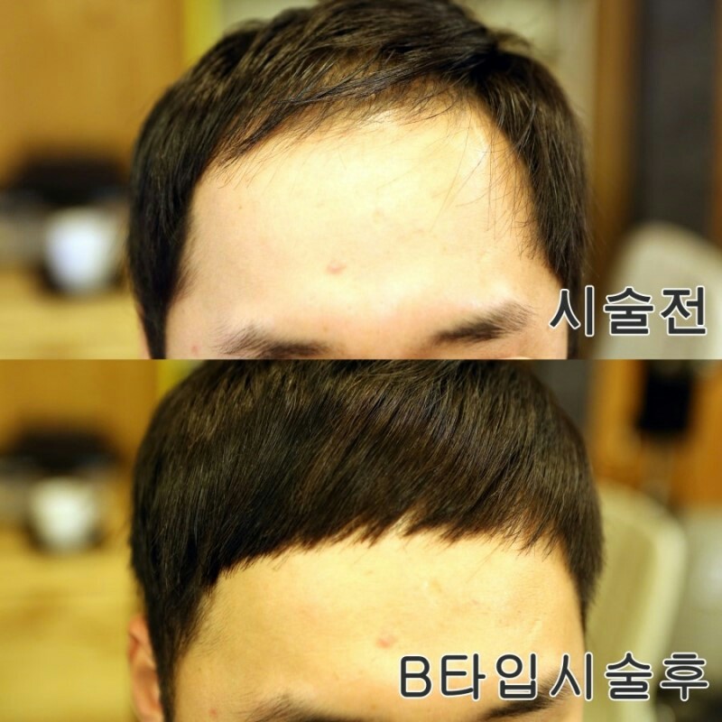 KakaoTalk_20170526_132612939.jpg
