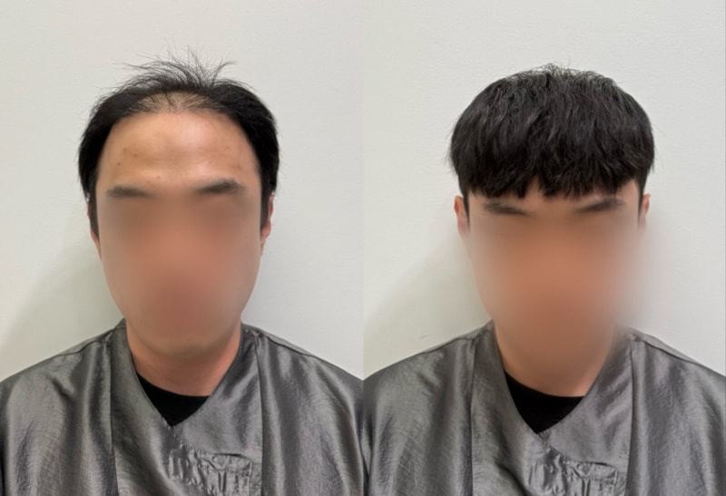다운로드.jpg