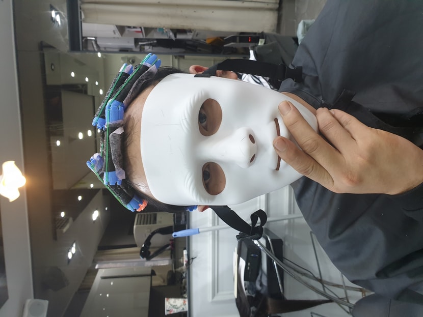 증모후 펌시술