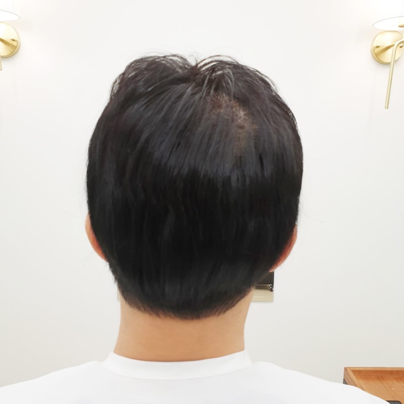 머리숱_없는_남자_5.jpg