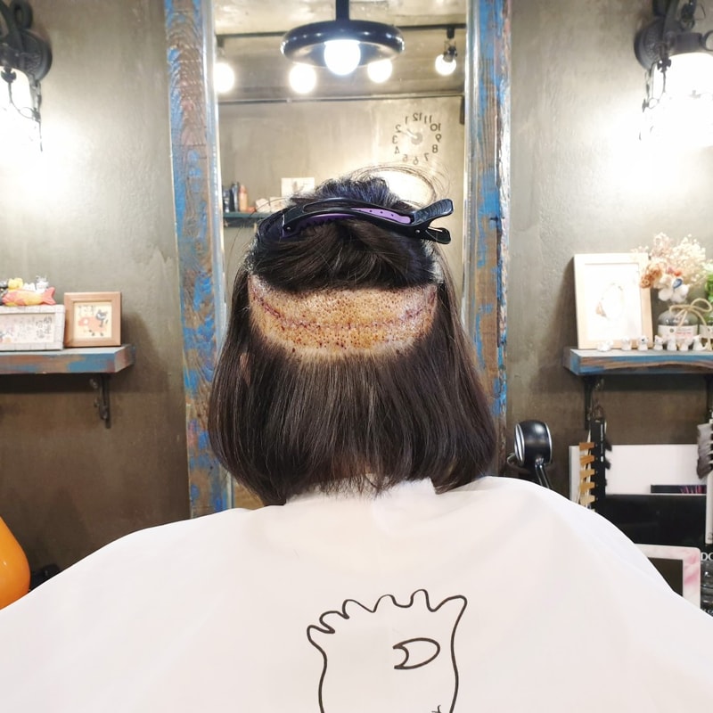 여자_m자_턀모_13.jpg