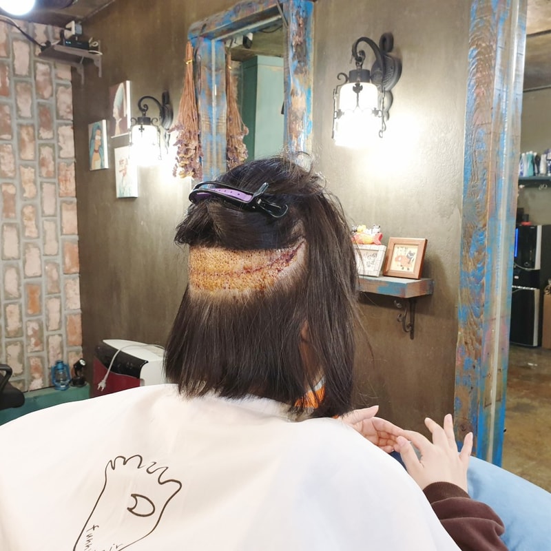 여자_m자_턀모_9.jpg