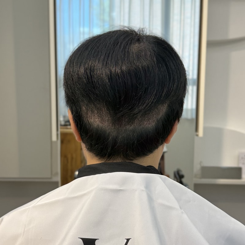 모발이식후  뒷머리 삭발부위 커버