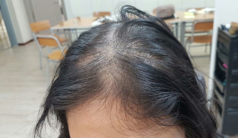코모리치 2.jpg