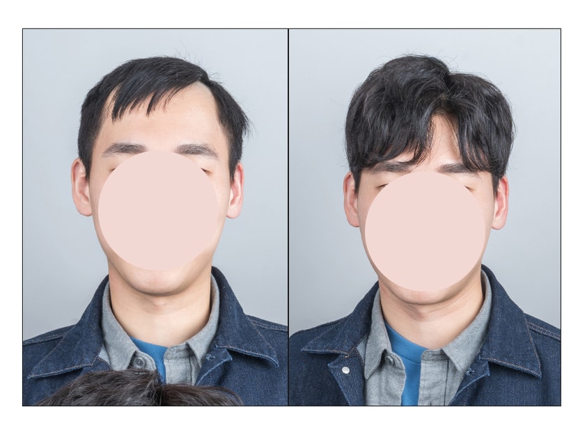 비포 & 에프터